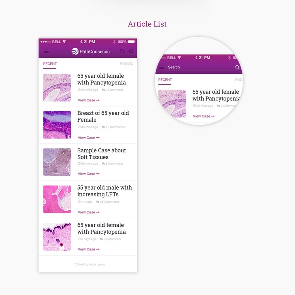 White and purple design with the title 'Pathconcensus mobile app'