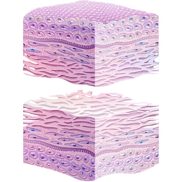 Healing design with the title 'CHORIOFIX Illustration'