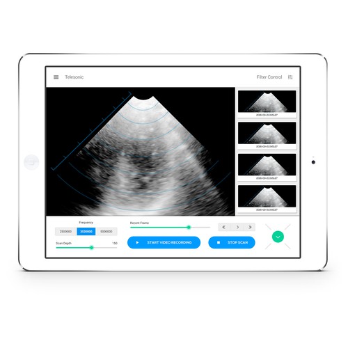 Scan design with the title 'Minimalist Scanning App'