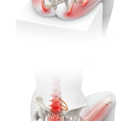 3d Medical Illustration