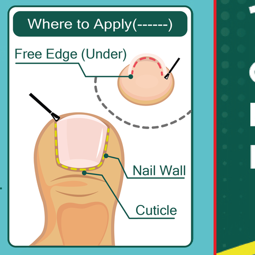 Design Nail Fungus Treatment - Application Diagram por Andy_Dev