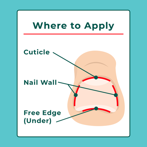 Nail Fungus Treatment - Application Diagram Design von Gogili design