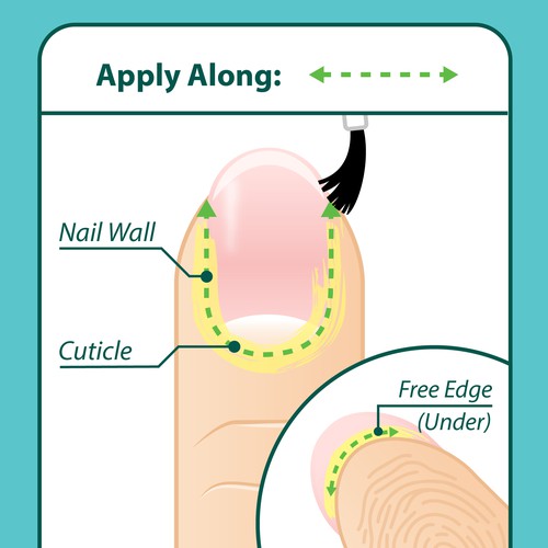 Design Nail Fungus Treatment - Application Diagram di Aerlith