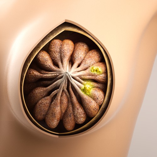 3-D Mammogram Image/Diagram Contest Design by Javad.S