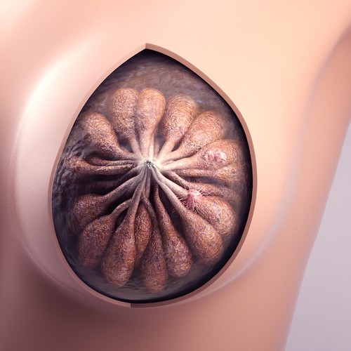3-D Mammogram Image/Diagram Contest Design by Javad.S