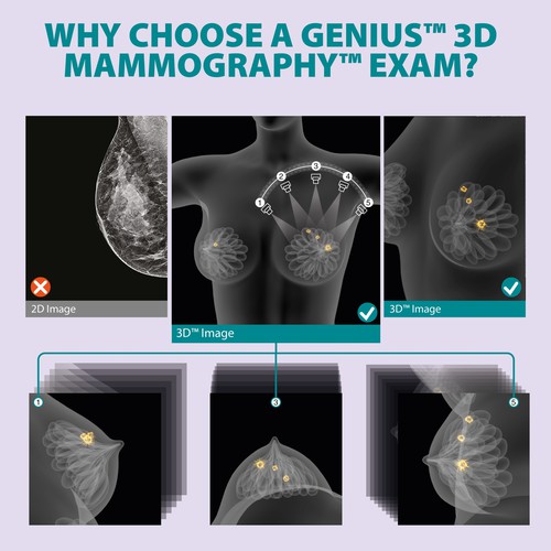 3-D Mammogram Image/Diagram Contest Design by Javad.S