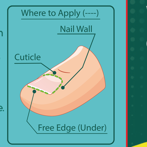 Design Nail Fungus Treatment - Application Diagram di Andy_Dev