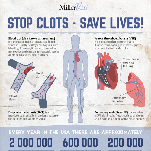 Create eye catching blood clot infographic to save lives! | Infographic ...