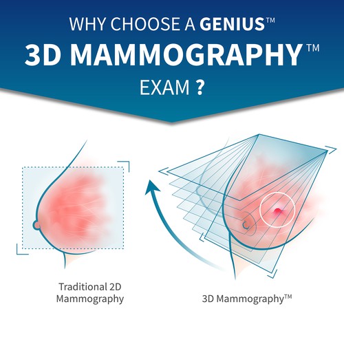 3-D Mammogram Image/Diagram Contest Design by AL8000