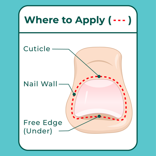 Design Nail Fungus Treatment - Application Diagram di Gogili design