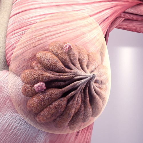 3-D Mammogram Image/Diagram Contest Design by Javad.S