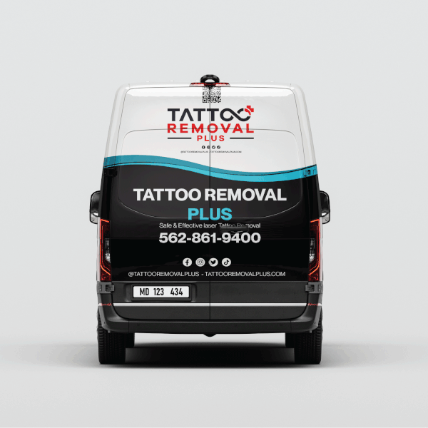 Tattoo Removal