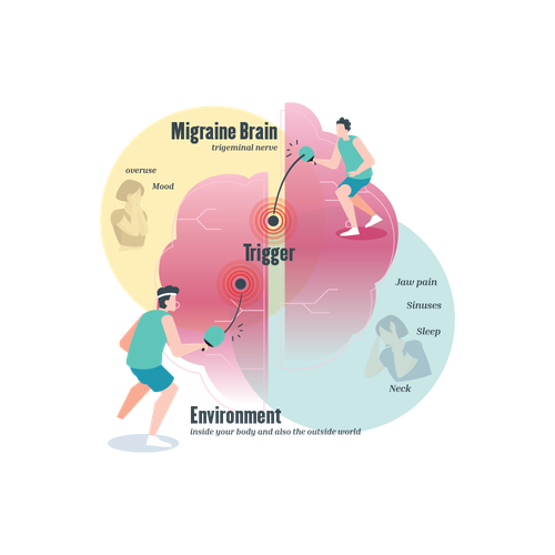 The Ping Pong theory : is migraine a cause or a consequence? - Migraine  Canada™