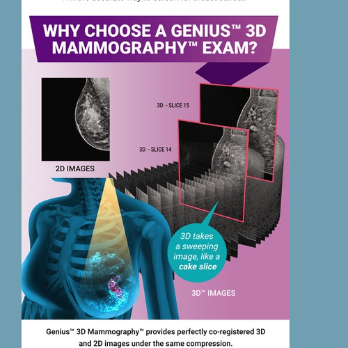 3-D Mammogram Image/Diagram Contest Design by thelembique