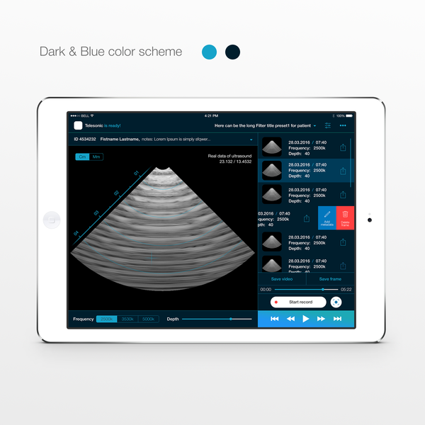 Telesonic UltraSound app