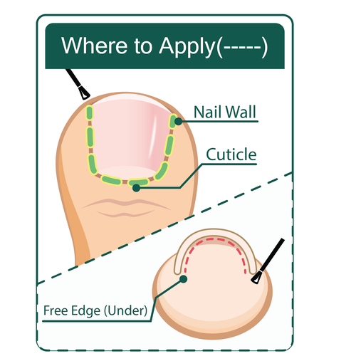 Diseño de Nail Fungus Treatment - Application Diagram de Andy_Dev