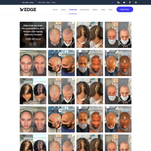 Designs | Scalp Micropigmentation modern and bold website redesign ...