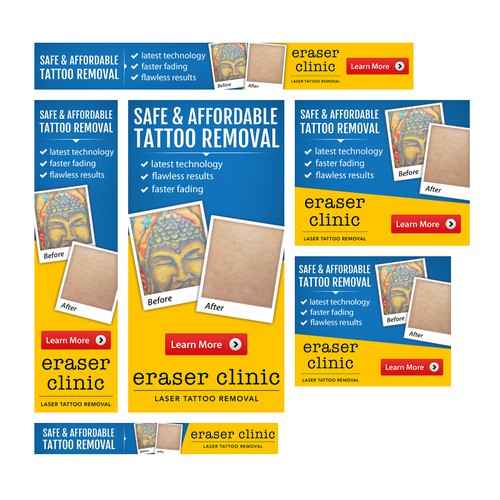 Banner ads for laser tattoo removal clinic | Banner ad contest | 99designs