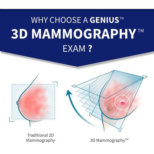 3-D Mammogram Image/Diagram Contest Design by AL8000