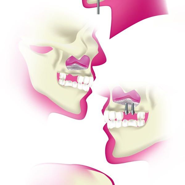 Design by Kapica Pawel titled "Dental Illustration"