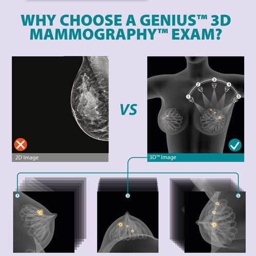 3-D Mammogram Image/Diagram Contest Design by Javad.S