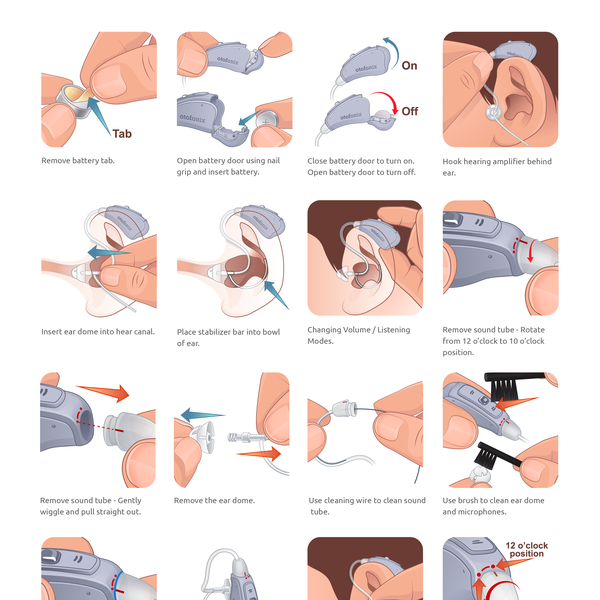 Quick Start Guide for Otofonix Apex