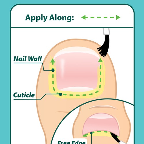 Nail Fungus Treatment - Application Diagram Design réalisé par Aerlith