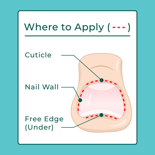 Diseño de Nail Fungus Treatment - Application Diagram de Gogili design