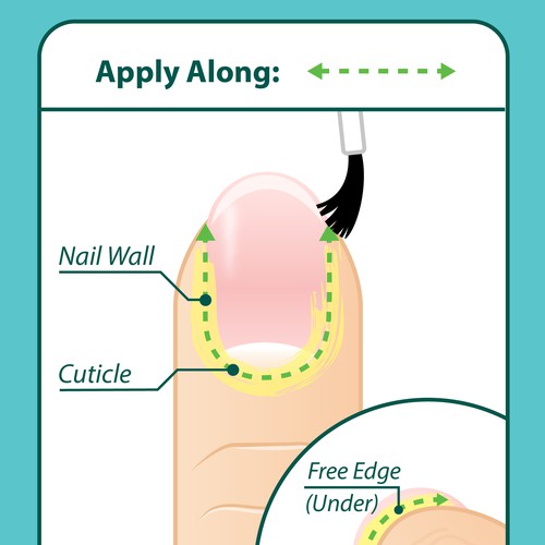 Diseño de Nail Fungus Treatment - Application Diagram de Aerlith