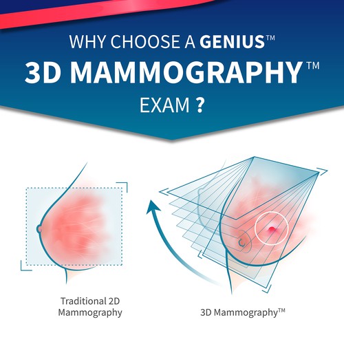 3-D Mammogram Image/Diagram Contest Design by AL8000