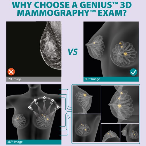 3-D Mammogram Image/Diagram Contest Design by Javad.S