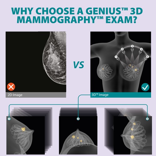 3-D Mammogram Image/Diagram Contest Design by Javad.S