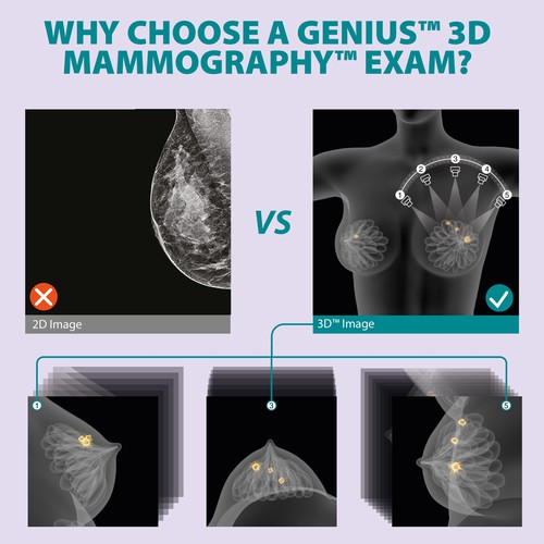 3-D Mammogram Image/Diagram Contest Design by Javad.S