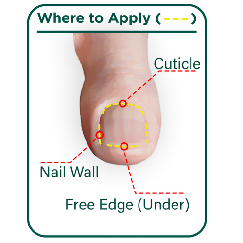 Nail Fungus Treatment - Application Diagram Design von Andy_Dev